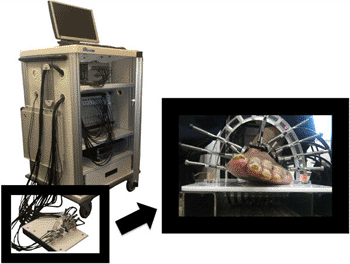 Imagen: Una técnica llamada tomografía óptica difusa dinámica (DDOT) está hecha para suministrar diagnósticos más tempranos en pacientes con enfermedad arterial periférica (Fotografía cortesía de la Universidad de Columbia).